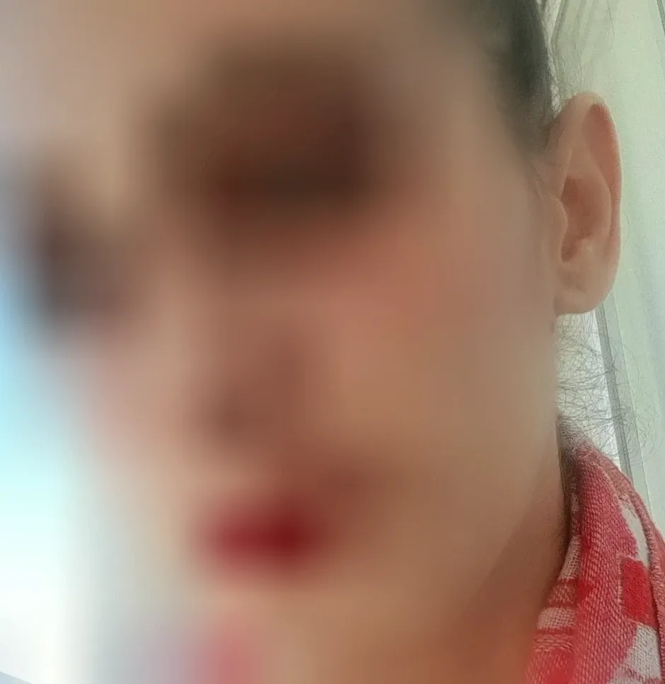 Özlem, 37
